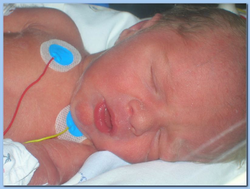 naissance corentin 073
